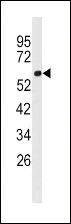 ACSL3 Antibody in Western Blot (WB)