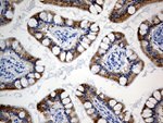 ACSL5 Antibody in Immunohistochemistry (Paraffin) (IHC (P))