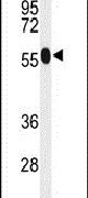 ACSM1 Antibody in Western Blot (WB)