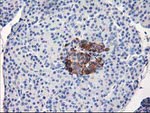 ACSS2 Antibody in Immunohistochemistry (Paraffin) (IHC (P))