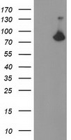 ACSS2 Antibody in Western Blot (WB)