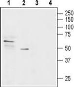 SLC22A1 Polyclonal Antibody