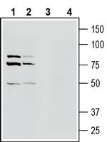 OCTN1/SLC22A4 Polyclonal Antibody