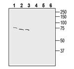 CTL1 (SLC44A1) (extracellular) Antibody in Western Blot (WB)