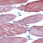 Skeletal Muscle Actin Antibody in Immunohistochemistry (IHC)