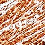 ACTA2 (smooth muscle actin alpha, SMA) Antibody in Immunohistochemistry (IHC)