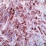 Alpha-Smooth Muscle Actin Antibody in Immunohistochemistry (IHC)