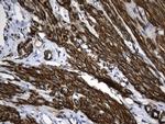 ACTA2 (smooth muscle actin alpha, SMA) Antibody in Immunohistochemistry (Paraffin) (IHC (P))