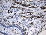 ACTA2 (smooth muscle actin alpha, SMA) Antibody in Immunohistochemistry (Paraffin) (IHC (P))