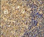 Actin Antibody in Immunohistochemistry (IHC)