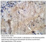 ACTH Polyclonal Antibody
