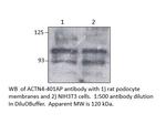 alpha Actinin 4 Polyclonal Antibody