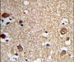 ACTR5 Antibody in Immunohistochemistry (IHC)