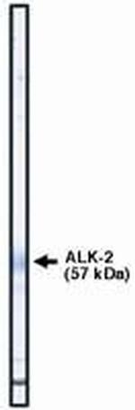 ACVR1 Polyclonal Antibody