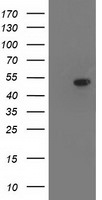 ACY1 Antibody in Western Blot (WB)