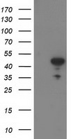 ACY1 Antibody in Western Blot (WB)