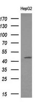 ACY1 Antibody in Western Blot (WB)