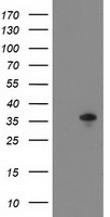 ACY3 Antibody in Western Blot (WB)