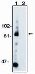 ADAM10 Antibody in Western Blot (WB)