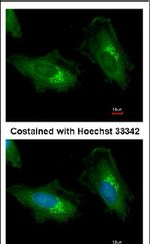 ADAM12 Antibody in Immunocytochemistry (ICC/IF)