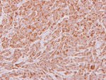 ADAM12 Antibody in Immunohistochemistry (IHC)