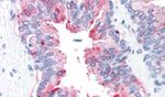 ADAM20 Antibody in Immunohistochemistry (Paraffin) (IHC (P))