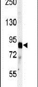 ADAMTS4 Antibody in Western Blot (WB)
