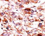 ADCK5 Antibody in Immunohistochemistry (IHC)