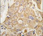 ADCY2 Antibody in Immunohistochemistry (IHC)