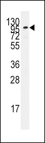 ADCY2 Antibody in Western Blot (WB)