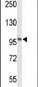 Adenylate Cyclase 7 Antibody in Western Blot (WB)
