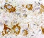 PACAP Receptor Antibody in Immunohistochemistry (IHC)