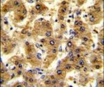 Alcohol Dehydrogenase 1B Antibody in Immunohistochemistry (IHC)