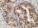 ADH1B Antibody in Immunohistochemistry (Paraffin) (IHC (P))