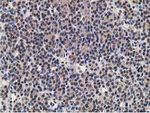 ADH1B Antibody in Immunohistochemistry (Paraffin) (IHC (P))