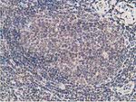 ADH1B Antibody in Immunohistochemistry (Paraffin) (IHC (P))