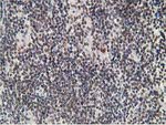 ADH1B Antibody in Immunohistochemistry (Paraffin) (IHC (P))