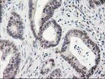 ADH1B Antibody in Immunohistochemistry (Paraffin) (IHC (P))