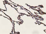 ADH1B Antibody in Immunohistochemistry (Paraffin) (IHC (P))