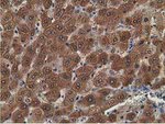 ADH1B Antibody in Immunohistochemistry (Paraffin) (IHC (P))