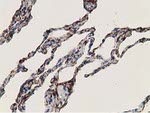 ADH1B Antibody in Immunohistochemistry (Paraffin) (IHC (P))