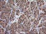 ADH1B Antibody in Immunohistochemistry (Paraffin) (IHC (P))