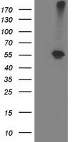 ADH1B Antibody in Western Blot (WB)