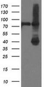 ADH1B Antibody in Western Blot (WB)