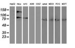 ADH1B Antibody in Western Blot (WB)