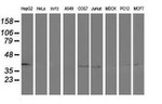 ADH1B Antibody in Western Blot (WB)