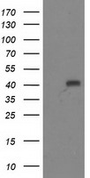ADH1B Antibody in Western Blot (WB)