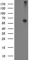 ADH1B Antibody in Western Blot (WB)