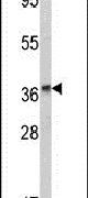 Alcohol Dehydrogenase 1B Antibody in Western Blot (WB)