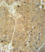 Alcohol Dehydrogenase 1C Antibody in Immunohistochemistry (IHC)